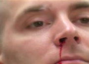 دلایل مهم خون دماغ شدن