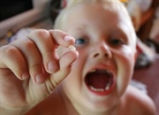 با دندان شکسته و یا کنده شده چه باید کرد؟