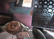 علل آب آوردن مغز