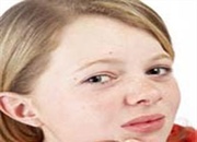 ﻿ بهترین درمان های خانگی برای جوش های سرسیاه