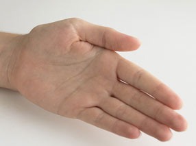 خارش کف دست همیشه مژده پول نیست