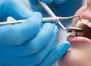 اصطلاحات/عبارات و واژگان مربوط به دندانپزشکی در انگلیسی