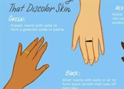 چرا حلقه ها انگشت شما را سبز می کنند و چگونه از آن جلوگیری کنیم؟