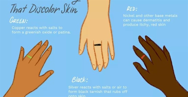 چرا حلقه ها انگشت شما را سبز می کنند و چگونه از آن جلوگیری کنیم؟