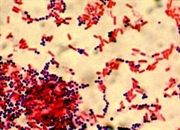 تفاوت های باکتری های گرم مثبت و گرم منفی: ساختار و عملکرد