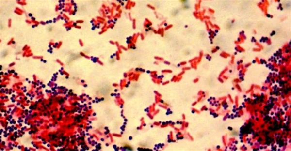 تفاوت های باکتری های گرم مثبت و گرم منفی: ساختار و عملکرد