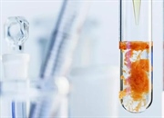 تفاوت بین اکسایش و کاهش: تعریف و مثال ها