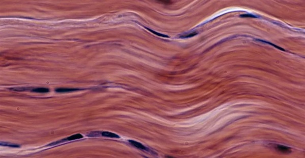 انواع بافت های همبند و نقش آن ها در بدن انسان