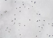 همه چیز درباره کک های برفی: حشرات بی بال کوچک