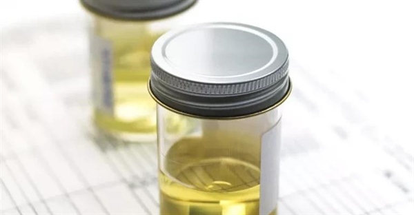 ترکیب شیمیایی ادرار چیست؟ راهنمای جامع بررسی رنگ و مواد تشکیل دهنده!