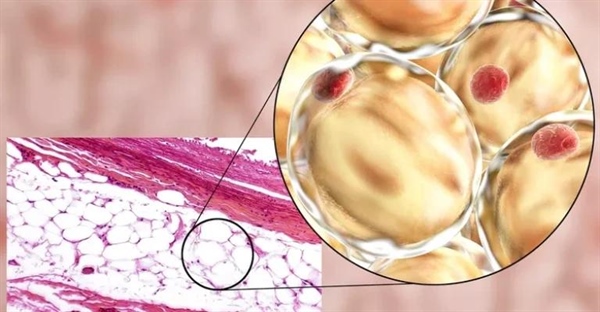 لیپیدهای اصلی و خواص آن‌ها: راهنمای جامع برای درک چربی‌ها