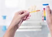 اسید چیست؟ تعریف، انواع، مثال‌ها و خواص اسیدها