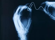 چرا اشیاء فلزی قبل از رادیولوژی باید خارج شوند؟ بررسی تاثیر فلزات بر عکس X-ray