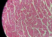 میوکارد قلب: ساختار، عملکرد و نقش حیاتی عضله قلبی