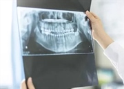 تاریخچه پرتو ایکس: از کشف تصادفی رونتگن تا سی‌تی اسکن مدرن