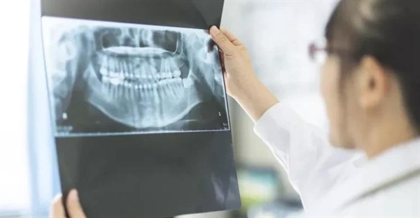 تاریخچه پرتو ایکس: از کشف تصادفی رونتگن تا سی‌تی اسکن مدرن