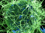 ��بولا: هر آنچه باید درباره این ویروس مرگبار بدانید!