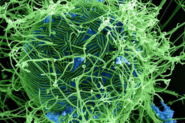 ��بولا: هر آنچه باید درباره این ویروس مرگبار بدانید!