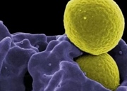 استافیلوکوکوس اورئوس مقاوم به متی‌سیلین (MRSA) چیست؟