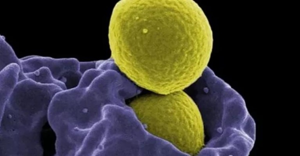 استافیلوکوکوس اورئوس مقاوم به متی‌سیلین (MRSA) چیست؟