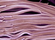 کلاژن چیست و چه نقشی در بدن ایفا می‌کند؟