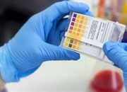 محاسبه pH اسیدهای قوی: راهنمای گام به گام + مثال