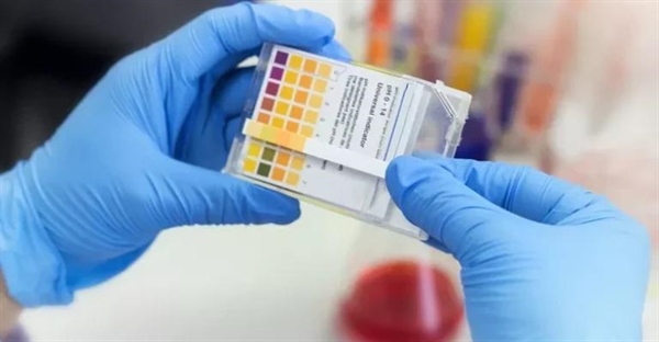 محاسبه pH اسیدهای قوی: راهنمای گام به گام + مثال