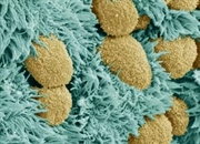 شبکه کوروئید: محافظ و تولید کننده حیات در مغز