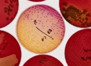 لیوفیلیزاسیون باکتری: راهنمای جامع خشک کردن انجمادی کشت باکتریایی