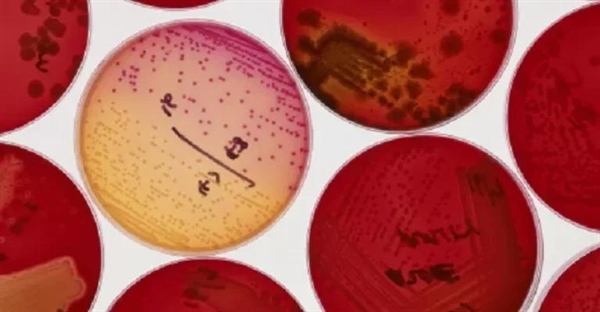 لیوفیلیزاسیون باکتری: راهنمای جامع خشک کردن انجمادی کشت باکتریایی