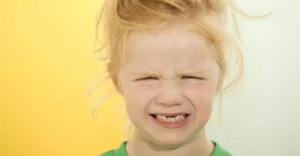 چرا دندان‌ها زرد می‌شوند؟ (و رنگ‌های دیگر!) + پیشگیری و درمان