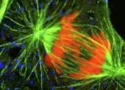 پراکسیزوم: اندامک یوکاریوتی حیاتی | عملکرد، تولید و نقش در سلول