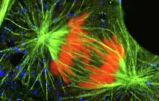 پراکسیزوم: اندامک یوکاریوتی حیاتی | عملکرد، تولید و نقش در سلول