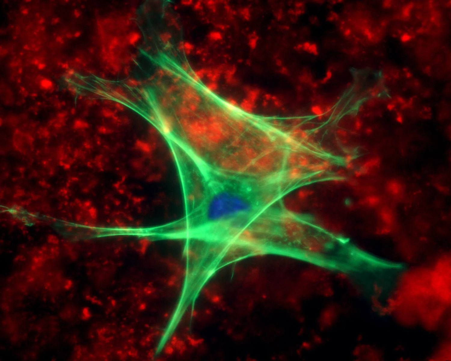 سلول های انسانی رنگ آمیزی شده با GFP.