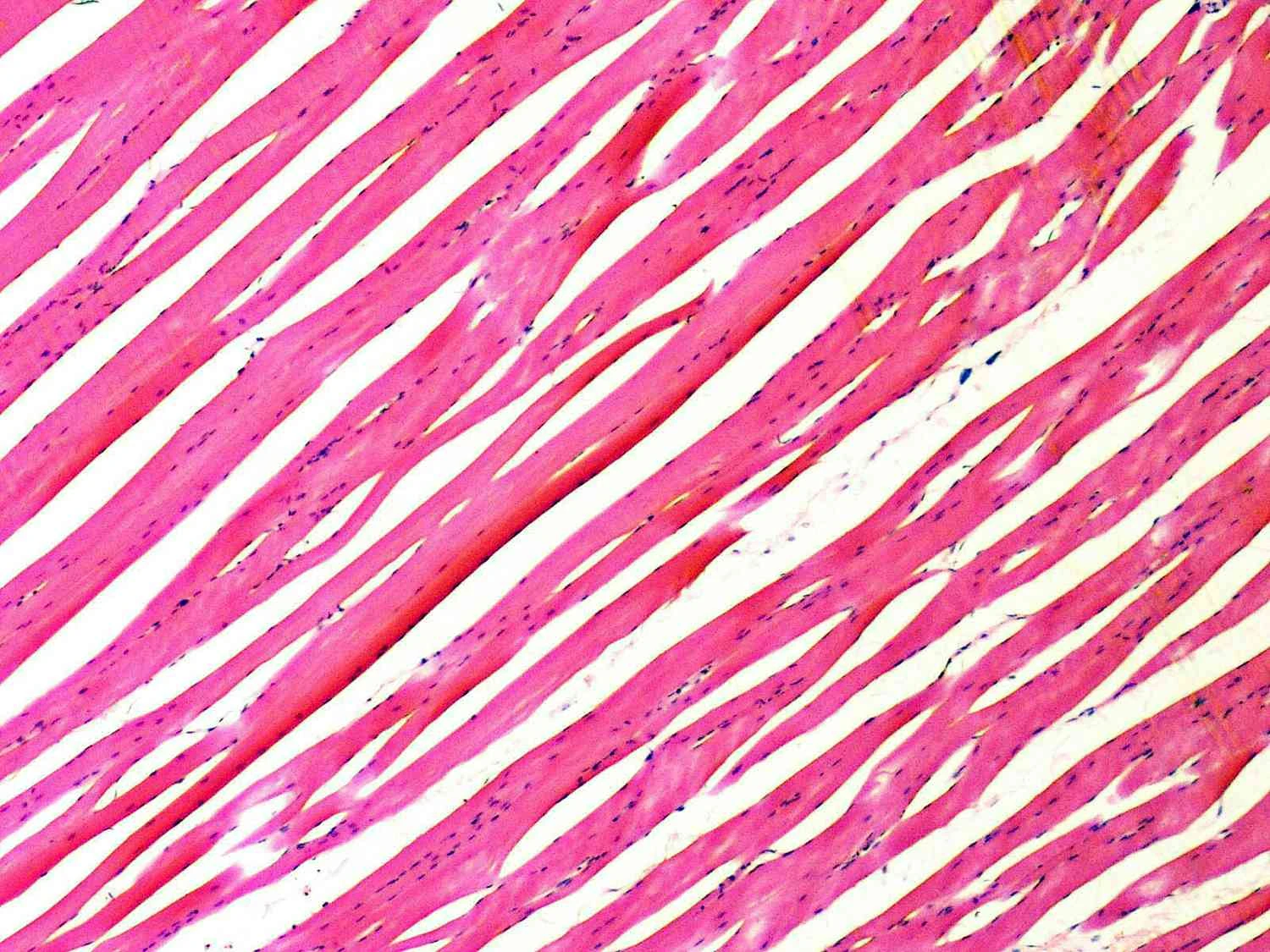 فیبرهای ماهیچه‌ای