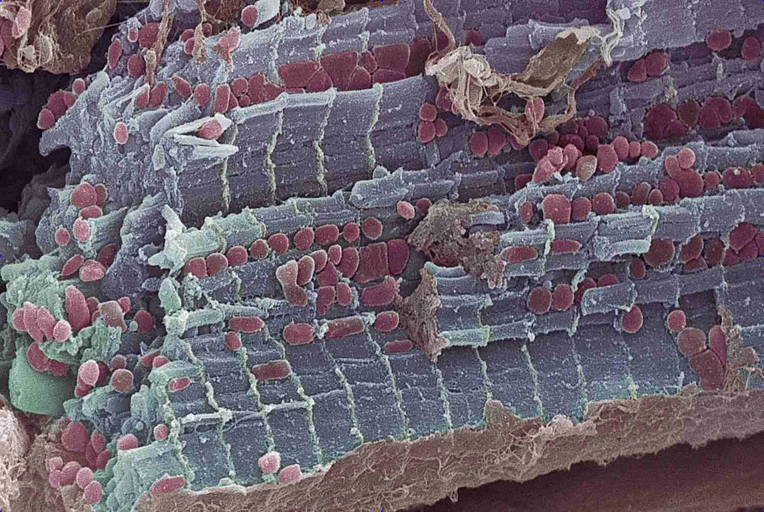 میوکاردیوم