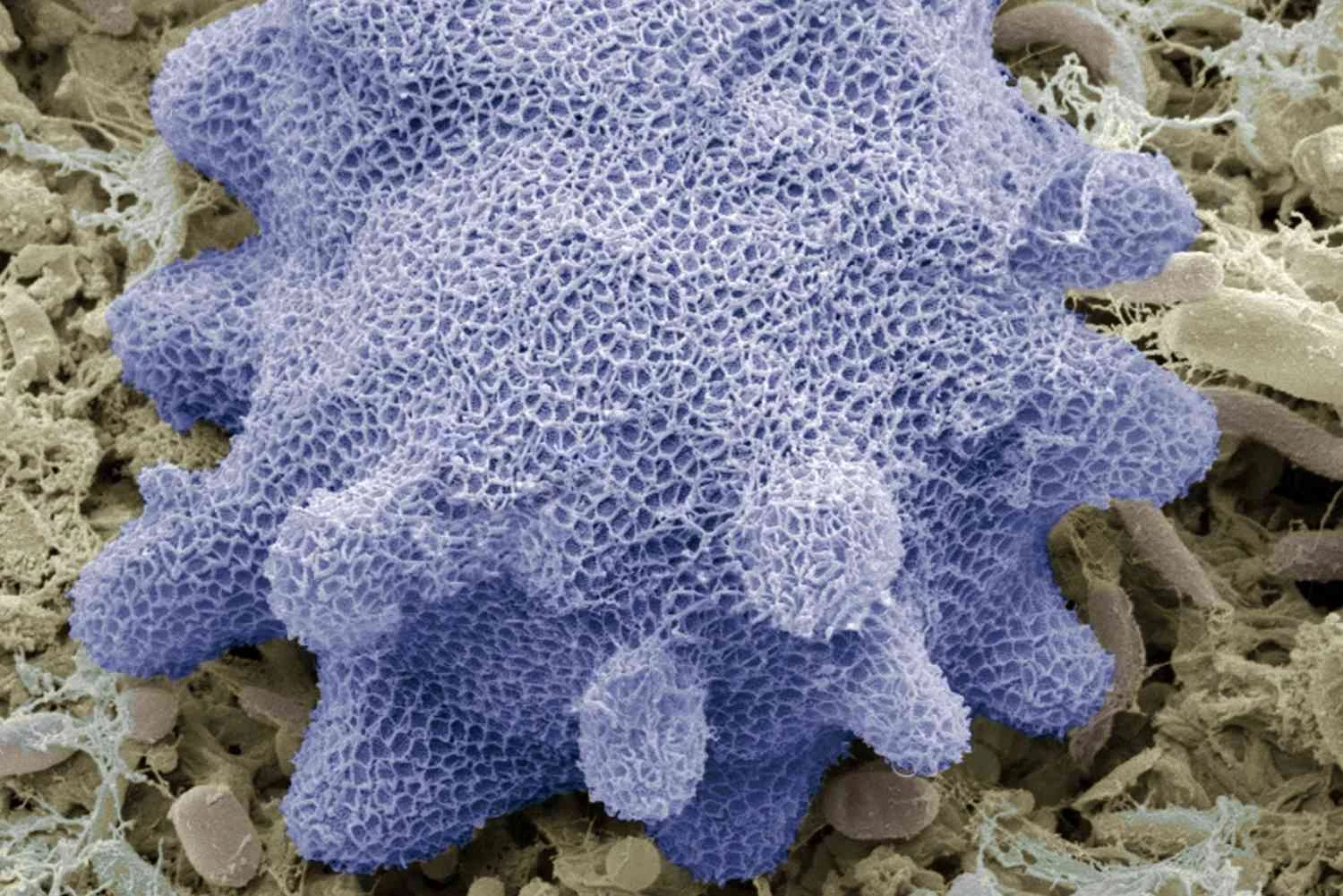 پروتیست های هتروتروفیک