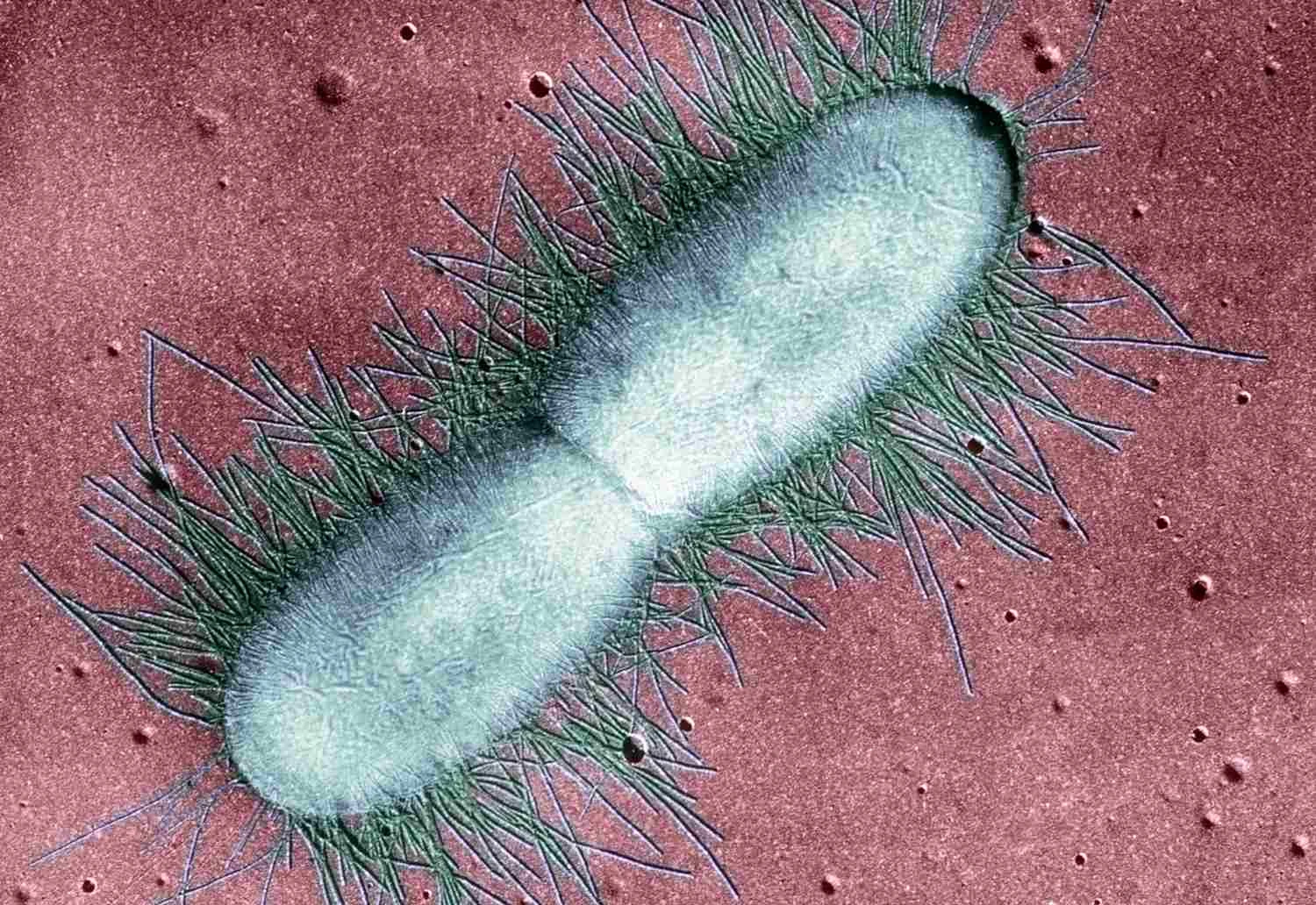 باکتری E. Coli