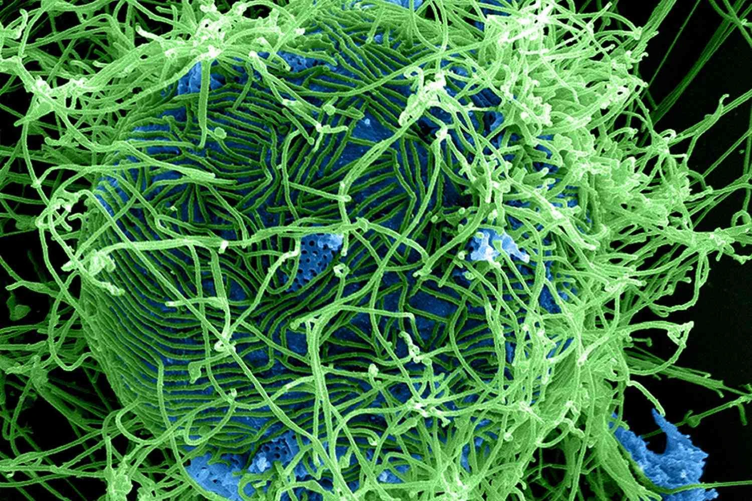 ویروس ابولا