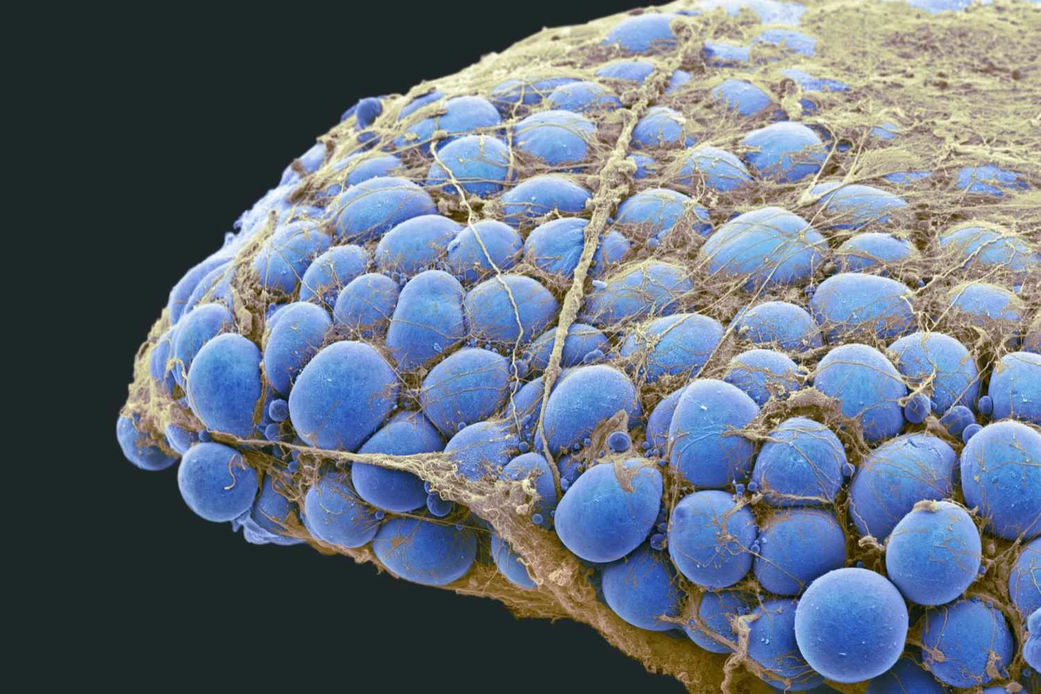 نمونه ای از بافت چربی