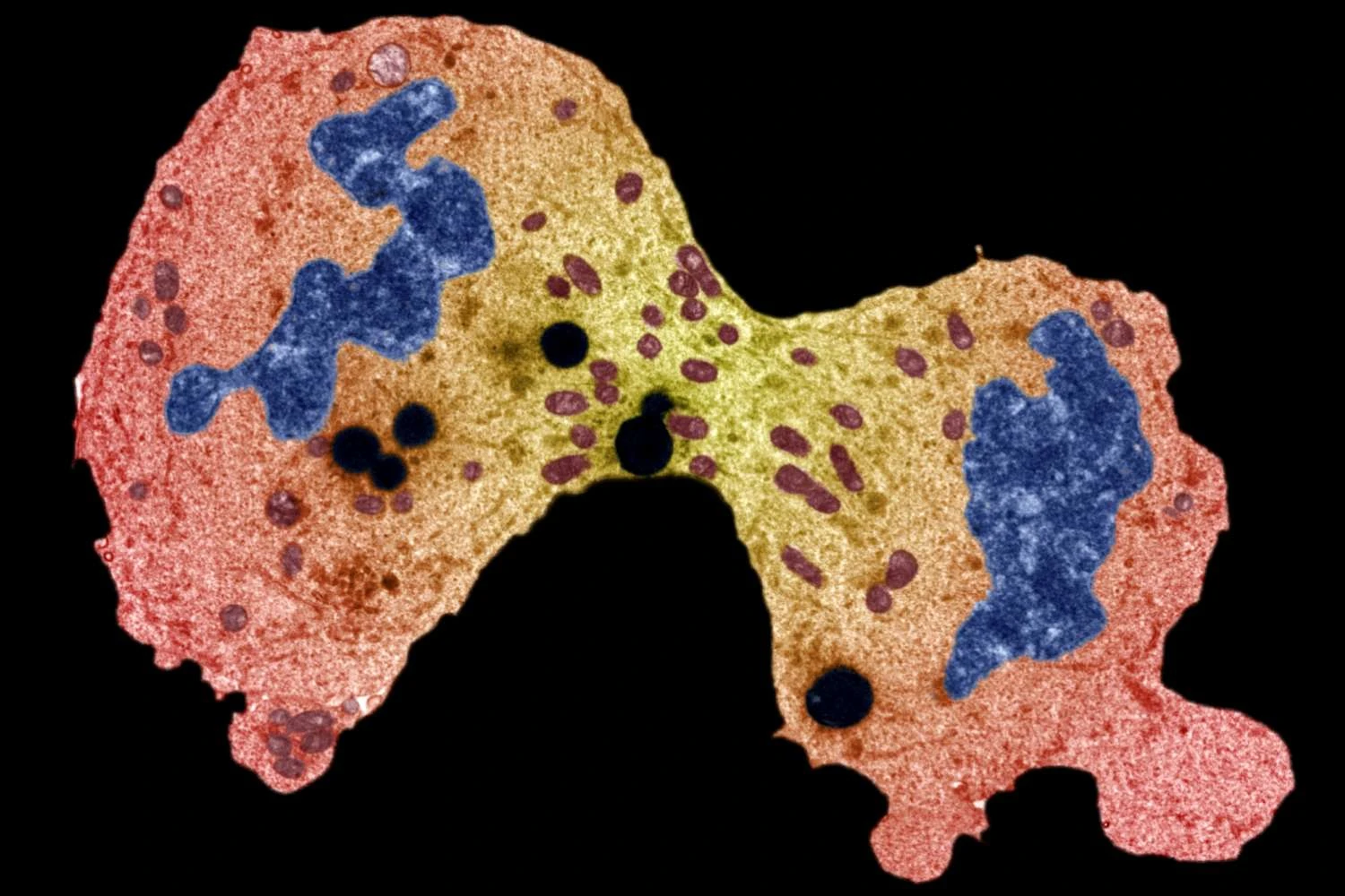 تقسیم سلول سرطانی