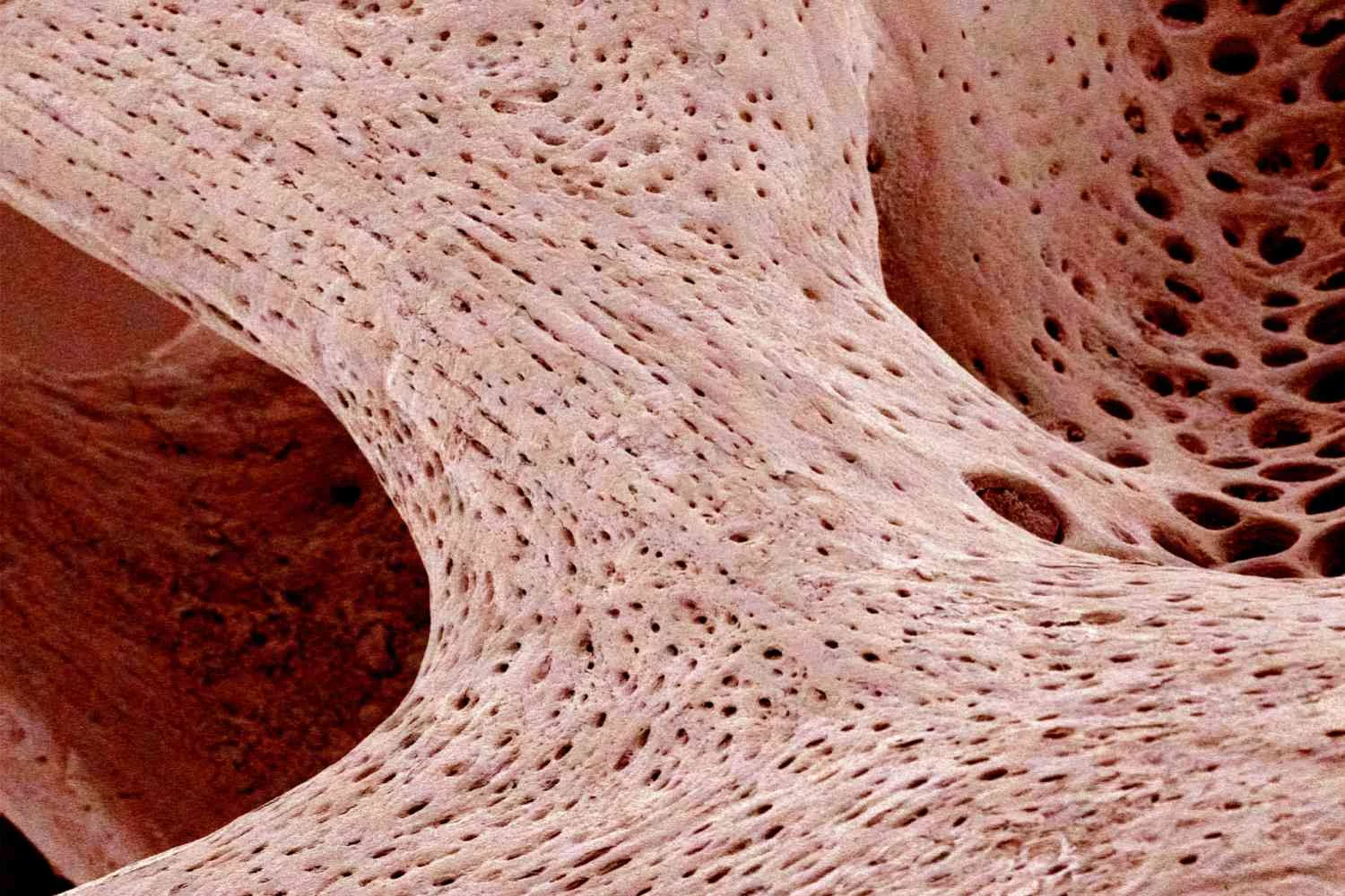تصویر میکروگرافی از استخوان اسفنجی (زبر) از یک مهره
