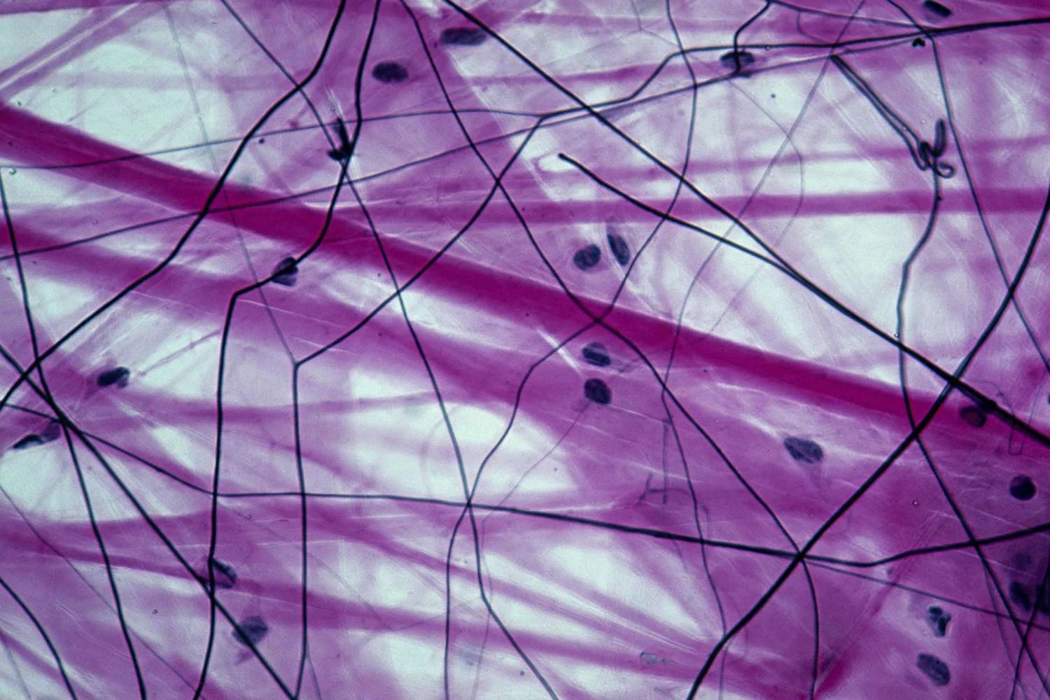 بافت پیوندی آزاد، الیاف کلاژنی (قرمز)، الیاف الاستیک (مشکی)، ماتریس و فیبروبلاست ها (سلول هایی که الیاف را تولید می کنند)