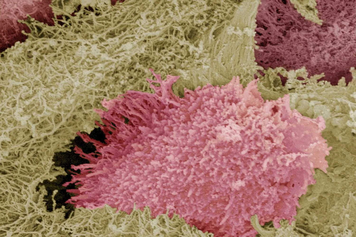 تصویر میکروگرافی از غضروف شفاف، یک بافت پیوندی نیمه سخت از نای انسان