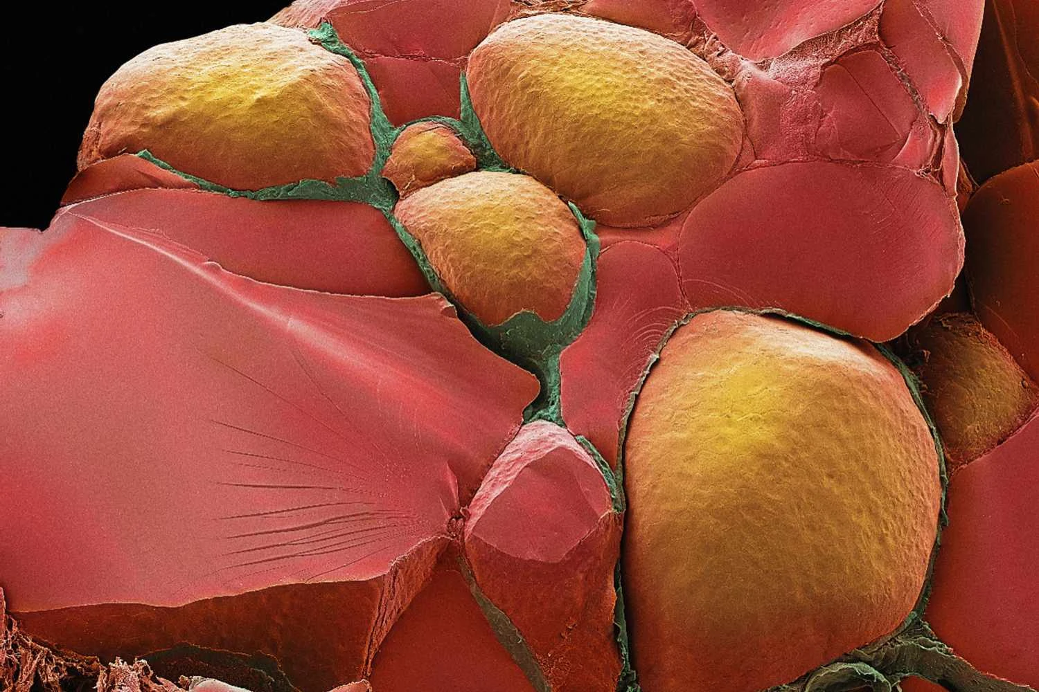 فولیکول های غده تیروئید